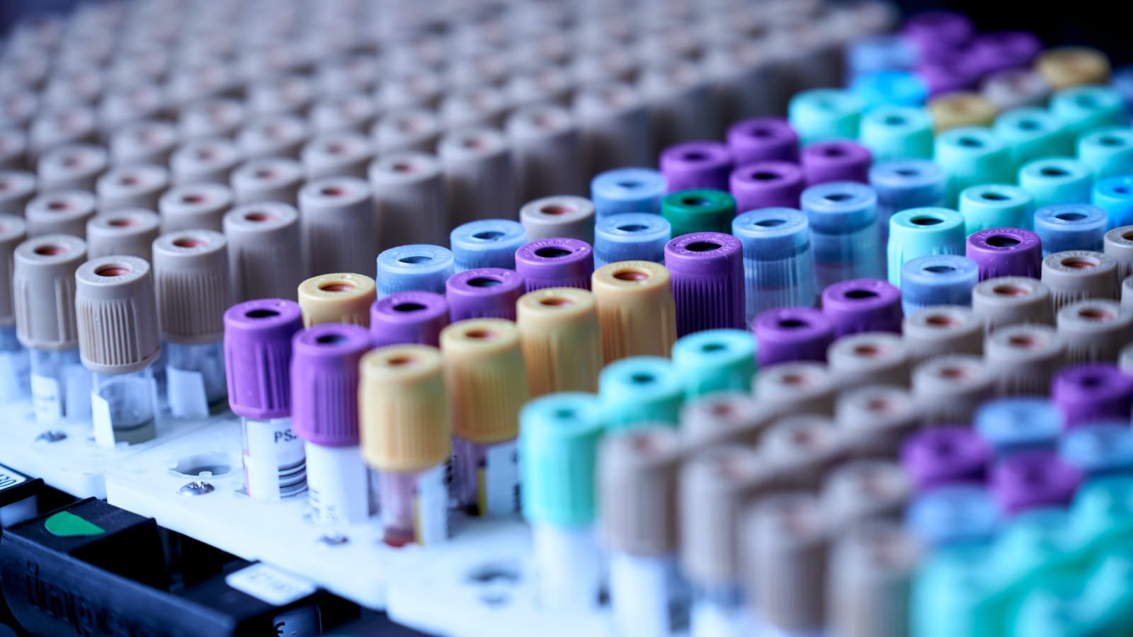US lab testing provider exposed health data of 1.6 million people
